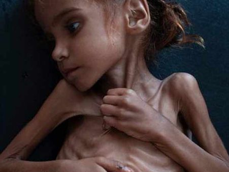 எப்போதும் சிரித்து கொண்டே இருப்பாள் அமல்.. ஆனால் நமக்கு கண்ணில் ரத்தம் வழிகிறது!