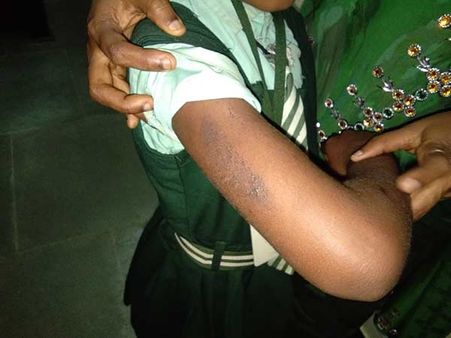 பல பெண்களுடன் தொடர்பு.. தாயில்லாத பிள்ளைக்கு தினசரி சூடு.. கொடூரத் தந்தையின் அடாவடி செயல்