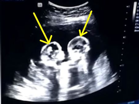 எம்ஜிஆர் பைட் பாத்திருப்பீங்க.. ஏன் ஜாக்கி சான் கூட பாத்திருப்பீங்க.. இந்த சண்டையை பாருங்க மக்களே!