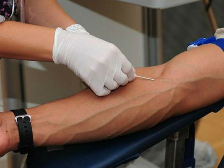 இந்து நோயாளிக்காக ரம்ஜான் நோன்பை கைவிட்ட முஸ்லிம் இளைஞர்.. மனிதநேயத்தை நிரூபித்த அசாம் இளைஞர்