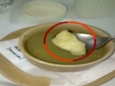 மருத்துவமனை கேண்டீன் சூப்பில் ரத்தக்கறை படிந்த பஞ்சு.. அதிர்ந்த நோயாளிகள்!