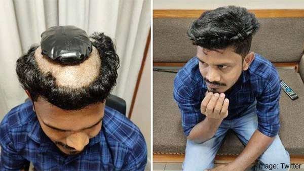 என்னங்கடா இது.. புது தினுசு கடத்தலா இருக்கே.. தலையை பார்த்து வாய் பிளந்த கேரளா!