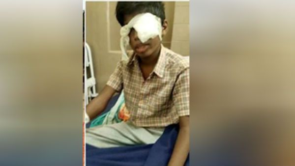 இரும்பு ஸ்கேலால் பலமுறை அடித்த டீச்சர்.. மூளையில் ரத்தகசிவு.. பார்வை பறிபோன பரிதாப மாணவன் கார்த்திக்