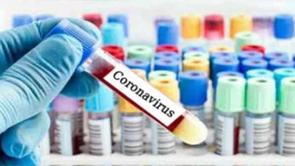 ஐசிஎம்ஆர் அனுமதி லேட்.. போலீஸ் அடிக்கிறார்கள்.. கொரோனா டெஸ்ட் செய்யும் தனியார் லேப்கள் குமுறல்