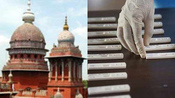 ரேபிட் டெஸ்ட் கிட் கொள்முதலுக்கு தடை.. சென்னை ஹைகோர்ட்டில் அதிரடி பொதுநல வழக்கு