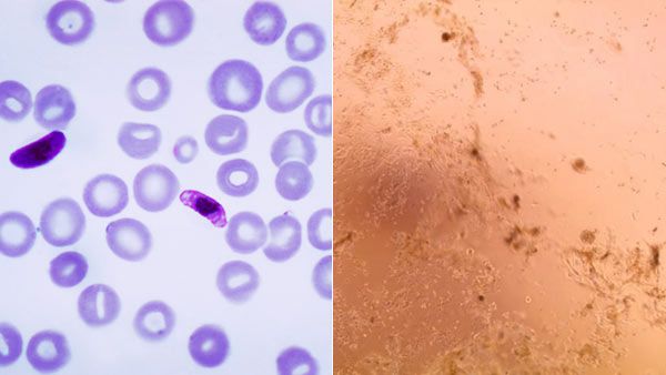  ஹைட்ராக்ஸிகுளோரோகுயின் Vs கொரோனாவைரஸ்: உடலுக்குள் நடப்பது என்ன?