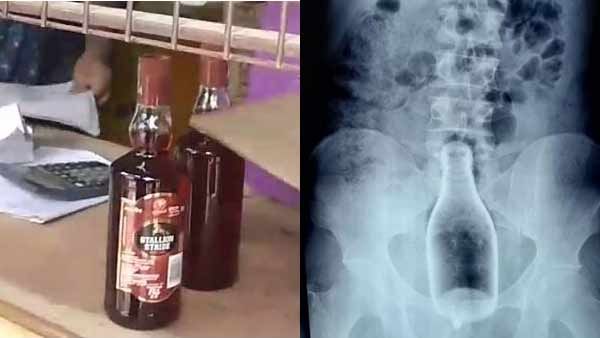 குடிபோதையில் மதுபாட்டிலை ஆசனவாயிலில் சொருகிய குடிகாரர்.. ஆப்ரேஷன் சக்சஸ்.. மருத்துவமனையில் கதறல்