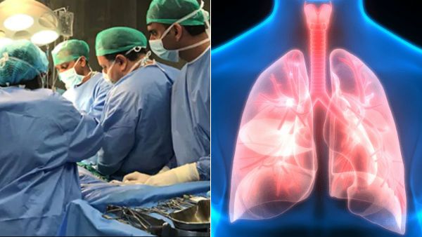 ஆசியாவிலேயே முதல்முறை.. கொரோனாவிலிருந்து மீண்டவருக்கு நுரையீரல் மாற்று சிகிச்சை.. சென்னையில் சாதனை!