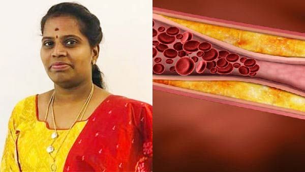 கொரோனாவுக்குப் பிந்தைய உடல் உபாதைகளால் அவதியா.. பயப்படாதீங்க.. ஈஸியாக எதிர்கொள்ளலாம்.. டாக்டர் தீபா