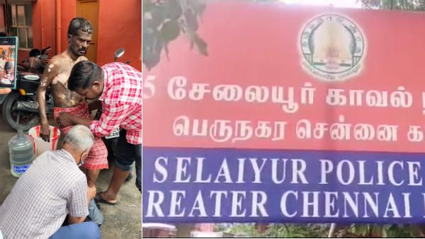 காதலனுடன் ஓடிய 13 வயது மகள்.. ஏளன பேச்சு.. சென்னையில் போலீஸ் ஸ்டேசன் முன்பு தீக்குளித்த தந்தை!