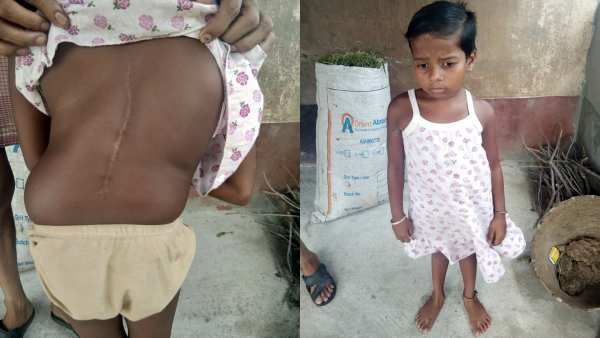 9 வயசுதான் ஆகிறது.. இந்த சிறுமிக்கு இப்படி ஒரு மோசமான வியாதி.. உதவுங்கள் ப்ளீஸ்