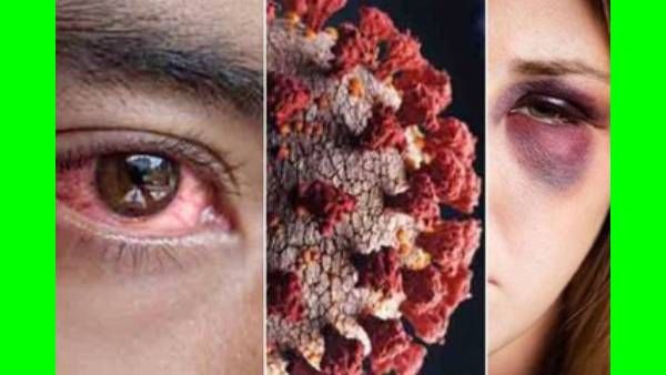 போச்சு.. ஒரே மாஸ்க்கை தொடர்ந்து போட்டால் 