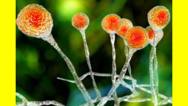 மூக்கில் கொட்டும் ரத்தம்.. விடாமல் ஜூரம்.. நாட்டில் முதன்முதலாக 34 வயது நபருக்கு 