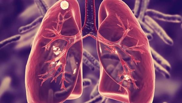 மத்திய அரசின் மாபெரும் சாதனை.. ஒரே ஆண்டில் 25% குறைந்த காசநோய் பாதிப்பு.. காரணம் கொரோனா ஊரடங்கு?