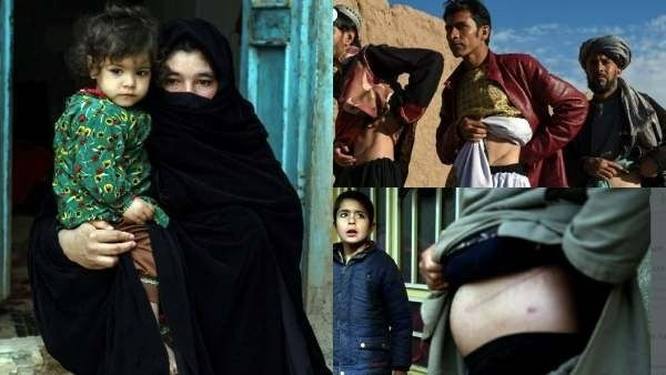 ''கிட்னிய விக்கலன்னா என் பொண்ண விக்கணும்..'' - பட்டினியால் ஆப்கானிஸ்தானில் தொடரும் அவல நிலை!