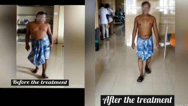 டிஸ்க் பல்ஜ், டிஸ்க் விலகி போச்சா?.. நடக்கவே முடியலையா?.. அரசு யோகா மருத்துவமனையில் சூப்பர் சிகிச்சை