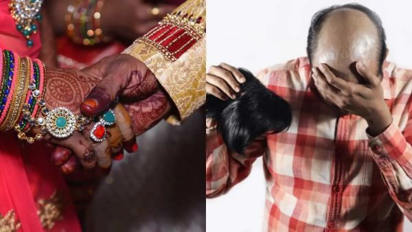 மயங்கிய மாப்பிள்ளை.. கழன்று விழுந்த விக்.. அதிர்ச்சியில் திருமணத்தை நிறுத்திய மணமகள்!