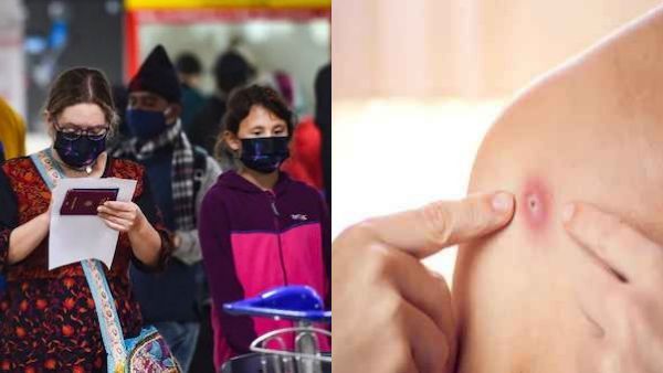 வெளிநாடுகளில் இருந்து இந்தியா வருவோருக்கு குரங்கு அம்மை பரிசோதனை... விமான நிலையங்களுக்கு உத்தரவு