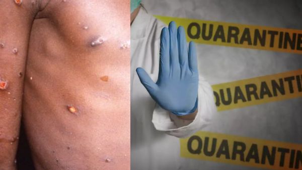 மீண்டும் வருகிறது தனிமைப்படுத்தும் விதி! முதல் நாடாக அறிவித்த பெல்ஜியம்.. காரணம் மங்கி பாக்ஸ்