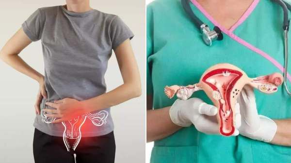 கருப்பை, கருமுட்டை நீக்கம் வரமா? சாபமா?.. வறுமைக்காக நீக்கும் அபாயம்?.. பக்க விளைவுகள் என்ன?