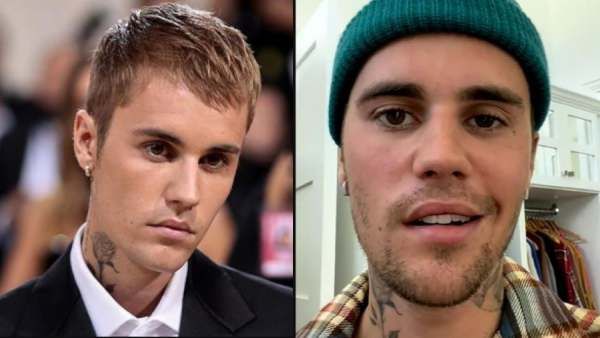 பிரபல பாப் பாடகர் ஜஸ்டின் பெய்பருக்கு.. மோசமான பக்கவாத பாதிப்பு.! ஒரு பக்க முகம் செயலிழந்தது!