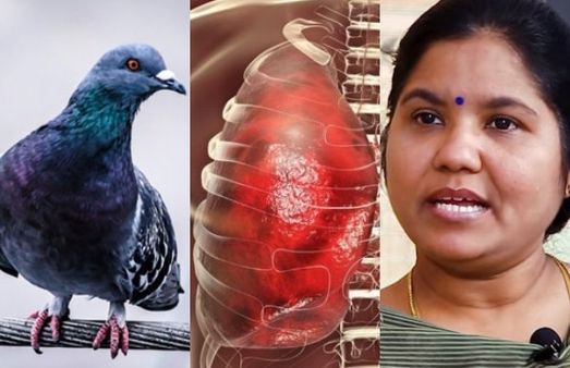 Exclusive:புறாக்களின் எச்சத்தால் நுரையீரல் பாதிப்பா?.. டாக்டர் சாந்தி ரவீந்திரநாத்தின் விளக்கம்!