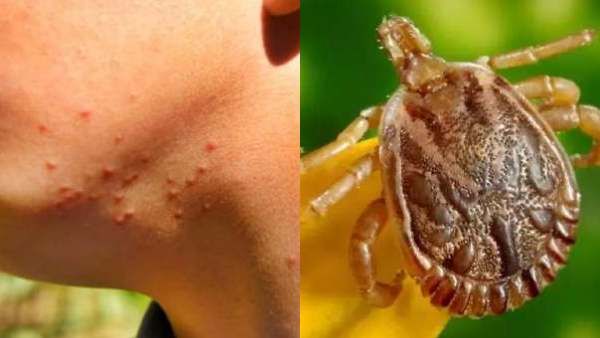 சிறுமியை கூட விடல.. அடுத்தடுத்து 2 பலி.. கேரளாவை வாட்டும் 