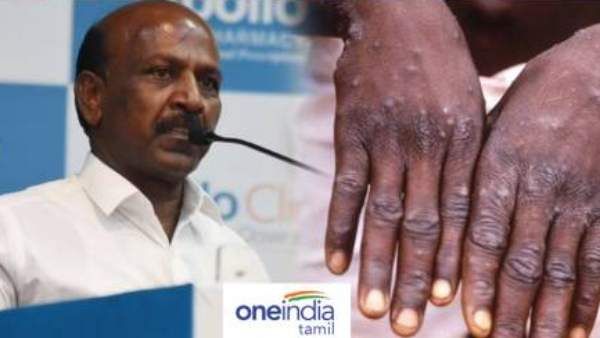 சென்னையில் குரங்கு அம்மை ஆய்வகம்.. மத்திய அரசு அனுமதி..செஸ் வீரர்களுக்கு பரிசோதனை - மா.சுப்ரமணியன்