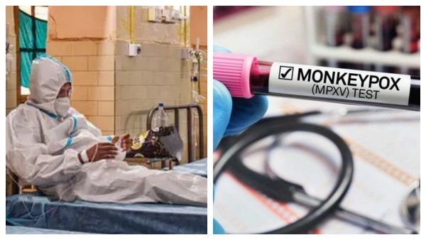 இந்தியாவில் முதல் மங்கி பாக்ஸ் மரணம்? பீதியை கிளப்பும் 