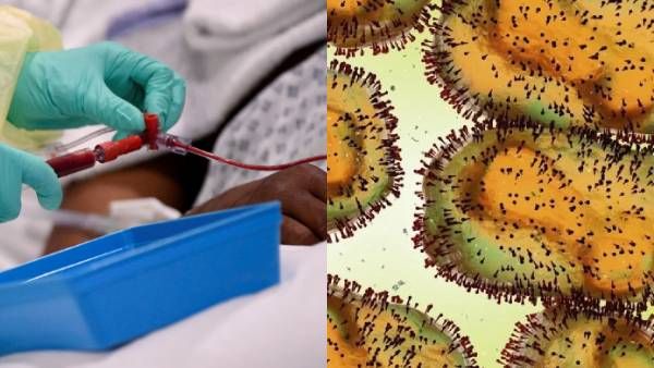 பிறப்பு உறுப்பில் புண்கள்! ரொம்ப வித்தியாசமாக உள்ள அறிகுறிகள்! கொரோனவை ஓவர்டேக் செய்யுமா மங்கிபாக்ஸ்