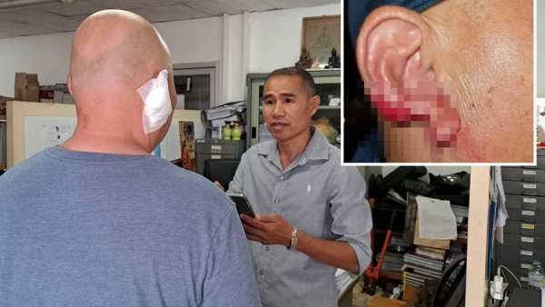 உச்சிக்கேறிய போதை! சுற்றுலா பயணியின் காதை கடித்து விழுங்கிய பாலியல் தொழிலாளி! தாய்லாந்தில் ஷாக்