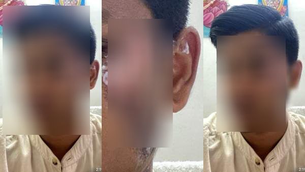 ஸ்டீம் ஃபேசியல்.. வெந்துபோன 17 வயது கோவை சிறுவன் முகம்! போலீஸுக்கு போன பெற்றோர்