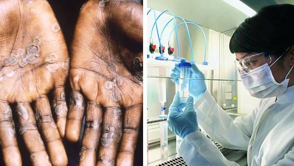 கம்ப்யூட்டர் மவுஸ், காபி மெஷினில் குரங்கு அம்மை வைரஸ் இருக்கலாம்.. எச்சரிக்கும் ஆய்வு முடிவு!