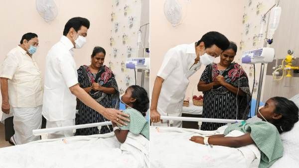 எப்படிமா இருக்க? நேரில் சென்ற முதலமைச்சர் ஸ்டாலின்.. நெகிழ்ந்த பெற்றோர்! சிறுமிக்கு கிடைத்த முகம்