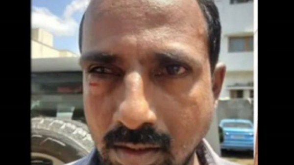 சீன் எடுக்க லேட்டுனு சொன்ன உதவி இயக்குநர்! முகத்திலேயே ஓங்கி குத்திய கண்ட நாள் முதல் சீரியல் நடிகர்