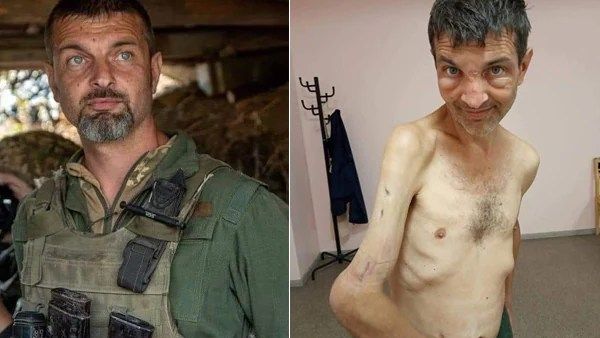 போர் கொடூரம்.. எப்படி இருந்தவர் இப்படி ஆகிட்டாரே.. ரஷ்யாவிடம் சிக்கிய உக்ரைன் வீரர் நிலையை பாருங்க