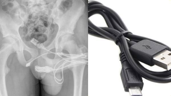 ஆணுறுப்பின் நீளத்தை அளக்க யூஎஸ்பி கேபிளை பிறப்புறுப்பில் நுழைத்த சிறுவன்.. கடைசியில் நடந்தது என்ன?