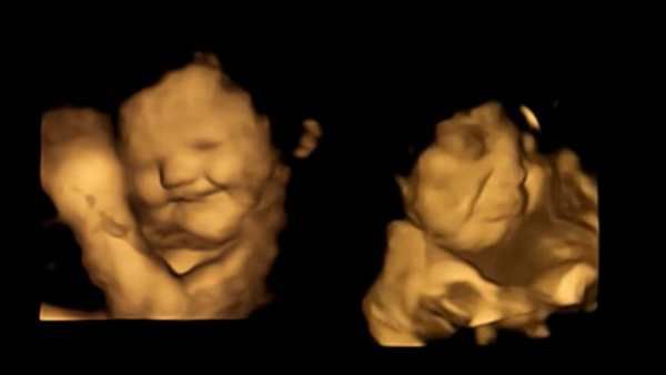 ஏம்மா கீரை எனக்கு பிடிக்காதுன்னு தெரியாதா? கருவிலேயே சிசு தந்த செம ரியாக்சன்.. வாவ்.. பாருங்களேன்!