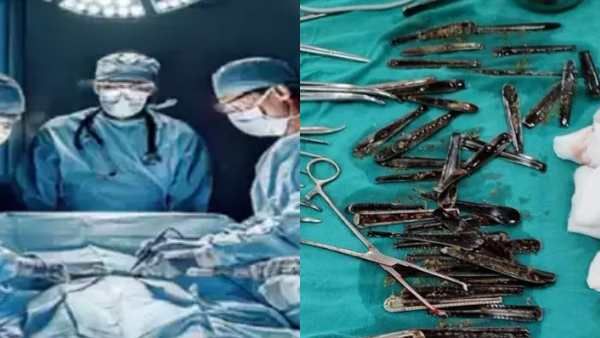 இது வயிறா.. 