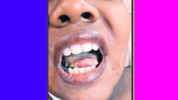 உறுப்பு வெந்து இறந்த பிஞ்சு.. காரணம் 