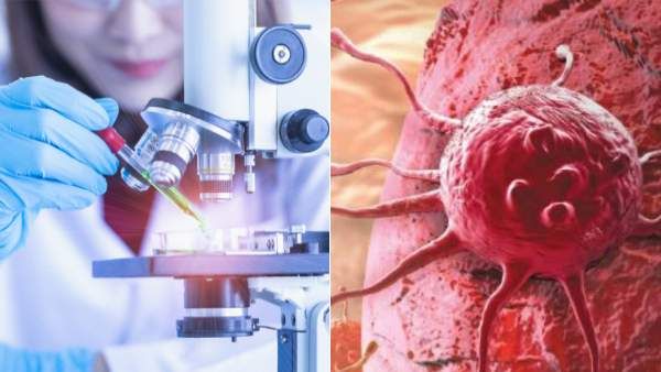 90s கிட்ஸுக்கு வந்த அடுத்த சோதனை! உங்களுக்கு தான் கேன்சர் வர வாய்ப்பு அதிகமாம்.. இது வேறயா