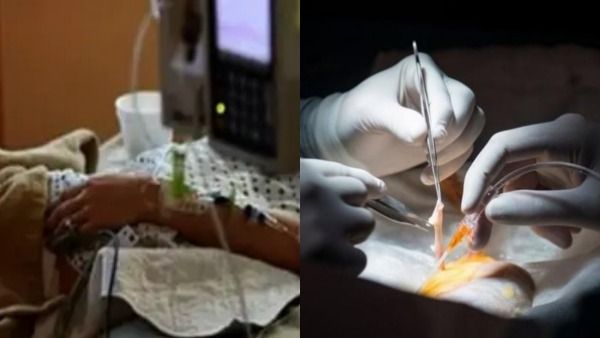 இரண்டு கத்தரிக்கோல்கள்! பெண்ணின் வயிற்றிலேயே வைத்து தைத்த மருத்துவர்கள்.. கேரளாவை அதிர வைத்த சம்பவம்