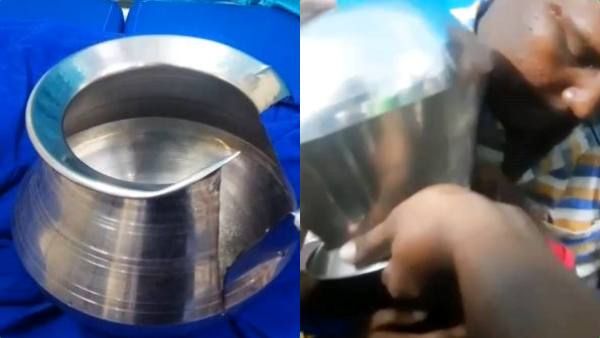 ஆஹா! விளையாடியது ஒரு குற்றமா!.. சில்வர் பாத்திரம் தலையில் சிக்கி பதறிய சிறுவன்.. கலங்கிய பெற்றோர்