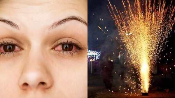 பட்டாசு வெடிக்கும் போது ஜாலிதான்..கண்ணில் பட்டால் காலிதான்.. டாக்டர்கள் சொல்லும் அறிவுரையை கேளுங்க