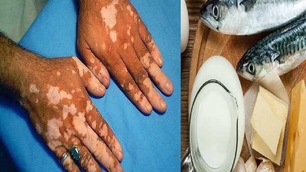 மீனையும் தயிரையும் சேர்த்து சாப்பிட்டால் தோல் பிரச்சனை வருமா? உண்மை என்ன தெரியுமா? FACT CHECK