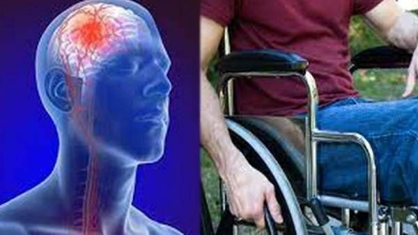 பக்கவாத அறிகுறிகள் வந்ததுமே 