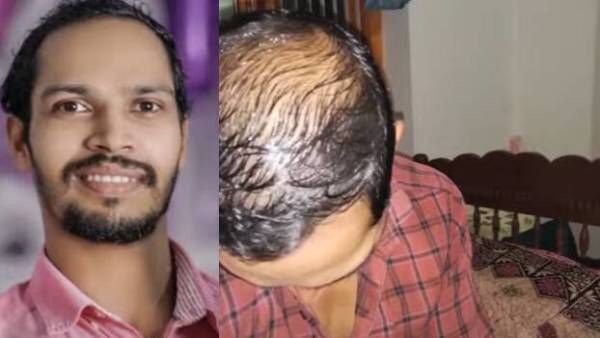 ஐயோ முடி போச்சே.. புருவமுமா.. அவசரப்பட்டு தற்கொலை செய்த வாலிபர்.. சிக்கிய சோக கடிதம்