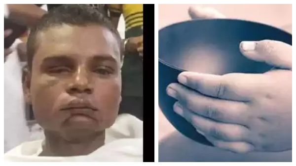 வேலை தேடிய இளைஞர் கடத்தல்.. பிச்சை எடுத்த கொடூரம்.. ரசாயன ஊசி போட்டு பார்வையை பறித்த டெல்லி மாபியா!