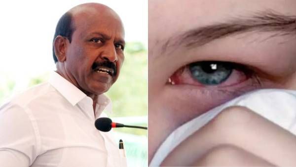 தமிழகத்தில் தினசரி 4500 பேருக்கு மெட்ராஸ் ஐ பாதிப்பு.. அமைச்சர் மா சுப்பிரமணியன் தகவல்