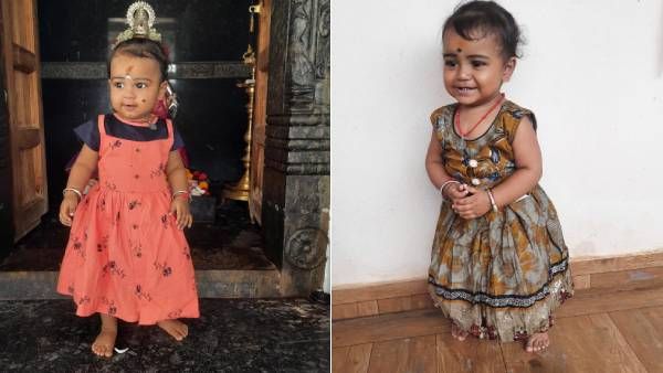 1 வயது குழந்தை கோபிகா.. உயிர் பிழைக்க இதய அறுவை சிகிச்சை அவசியம் - உதவுங்களேன் ப்ளீஸ்